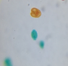 Tiêu bản tảo lục đơn bào - DMK1968