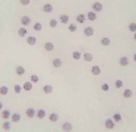 Tiêu bản ký sinh trùng sốt rét plasmodium falciparum - DMK3327 
