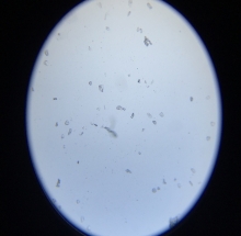Tiêu bản bào tử nấm linh chi - DMK2916