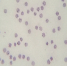 Tiêu bản ký sinh trùng sốt rét plasmodium falciparum - DMK3327 