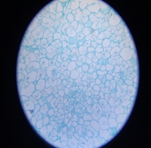 Tiêu bản tế bào dự trữ tinh bột khoai tây - DMK2910